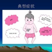 胎儿胆道闭锁（胎儿胆道闭锁）