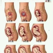 胎儿离宫颈口近的原因（胎儿离宫颈口近的原因）