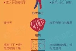 孕期湿疹什么原因导致的（孕妇长湿疹是什么原因？是体质变弱的原因吗）