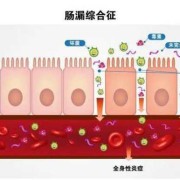 肠上皮的结构特点,胎儿肠外漏导致原因