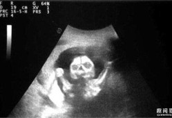 b超胎儿腿短是个子矮吗（怎么看宝宝是不是腿短）