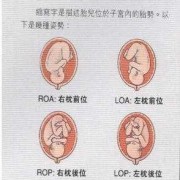 什么叫定胎位,