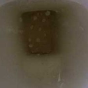 孕期尿有泡沫（孕期尿有泡沫是什么问题）