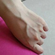 孕期有青筋（孕期青筋暴起是什么原因）