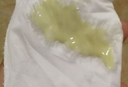 孕期白带黄绿（怀孕白带水黄绿色怎么办？孕初期白带水黄绿色是怎么回事）