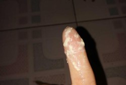 怀孕了白带像牛奶一样的是怎么回事啊,