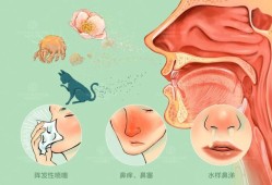 孕妇过敏性鼻炎对胎儿有影响吗？会造成什么影响呢,过敏性鼻炎对胎儿影响严重吗