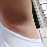 孕期下面黑（孕期下面黑）