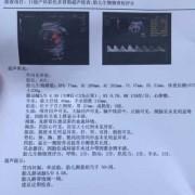 sd值偏高胎儿能要吗（sd值偏高胎儿能要吗）
