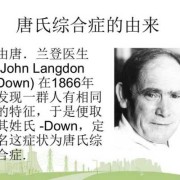 孕期伴随综合症（唐氏综合征介绍，唐氏综合征是什么病）