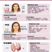 孕妇甲亢对胎儿有哪些影响,孕期甲亢严重还是甲减严重
