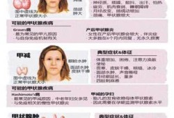 孕妇甲亢对胎儿有哪些影响,孕期甲亢严重还是甲减严重
