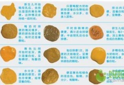 孕期便便多（孕期便便多是怎么回事）