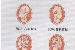 胎位RSA是什么意思，我不明白,孕期骶骨疼是怎么回事