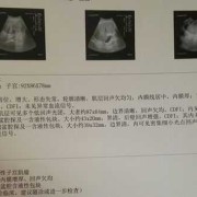 怀孕6个半月了检查子宫肌瘤变性了、会不会有什么危险,孕期子宫肌瘤变性很疼怎么办