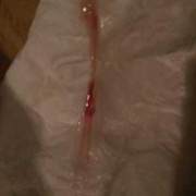 孕期有少量出血（怀孕14周，一切正常，突然流血，怎么回事）