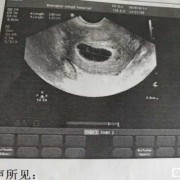 胎儿胎囊会萎缩吗（孕囊大胎芽小正常吗）