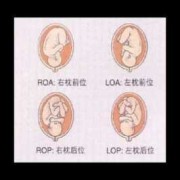 胎儿方位（胎儿方位LOA是什么意思）