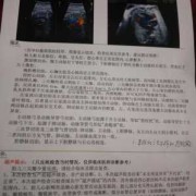胎儿三尖瓣少量反流（胎儿三尖瓣少量反流什么原因造成的）