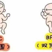 宝宝双顶径太大是不是因为吃了DHA啊,胎儿双顶径偏大的原因有哪些?