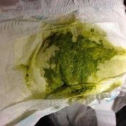 怀孕了白带变绿色是什么原因,