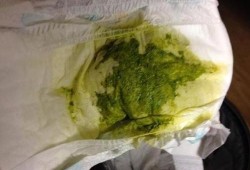 怀孕了白带变绿色是什么原因,