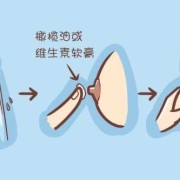 孕期乳头脏（乳头上的脏东西怎么清理）