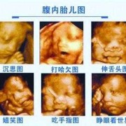 胎儿畸形怎么办（四维彩超检查出胎儿畸形怎么办）