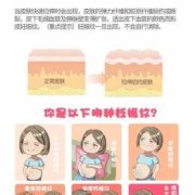 孕期妊娠纹怎样消除（如何去肚子的妊娠纹）