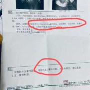 孕期左侧囊肿（左侧附件区囊肿怎么治）
