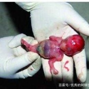4个月宝宝吓到了，怎么办,胎儿四个月发育标准图片