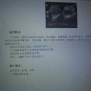 怀孕8周胎儿图片尺寸（怀孕8周胎心177正常吗）