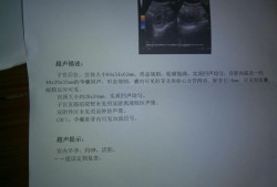 怀孕8周胎儿图片尺寸（怀孕8周胎心177正常吗）