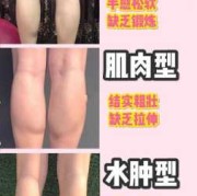 孕期大腿长肉原因（孕期大腿长肉是什么原因）