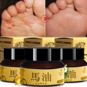 孕期治疗脚气（孕期治疗脚气的药会导致胎儿畸形吗?）