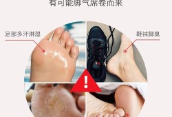 孕期长脚气（孕妇的脚气怎么治？可以抹什么脚气膏）