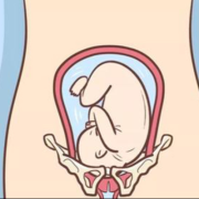 孕期孩子头大是什么原因,胎儿头高能顺产吗