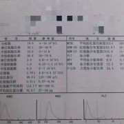 孕期积液增多（水量大的原因是什么）