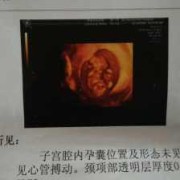 105天的宝宝视力能看多远,105天的胎儿有多大图解