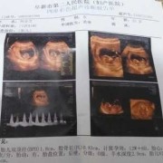 怀孕十二周胎儿多大（孕十二周胎心162，这个数据正常吗）