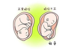 摸到胎儿硬硬的部位是（摸到胎儿硬硬的部位是宫缩吗）