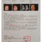 胎儿开始偏大后来偏小（使天平的测量结果偏大、偏小的情况）