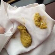 怀孕后大便就很多了是怎么回事,孕期屎特别多老放屁正常吗