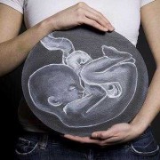 胎儿男抱母典型图（胎儿男抱母典型图片大全）