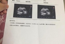 怀孕19周，每次给宝宝测胎心都在肚子左下方，正常吗,怀孕19周胎儿图片欣赏