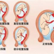 为什么胎盘里没有胎伢,胎儿是在胎盘里面吗还是子宫里面
