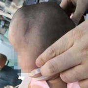 胎儿头很大（3个月的宝宝头老是往后挺是怎么回事啊）