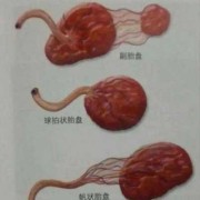 胎盘胎儿面（猪胎盘长什么样）