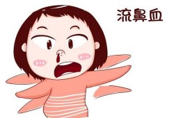 孕吐流鼻血怎么回事,怀孕期间流鼻血是什么原因