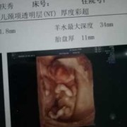胎儿面对面是男孩女孩（胎儿面对面是男孩女孩怎么看）
